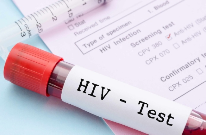 HIV test